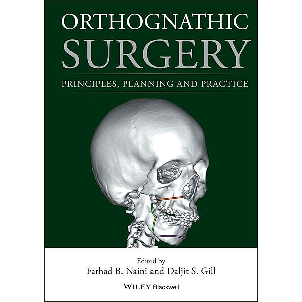 Orthognathic Surgery