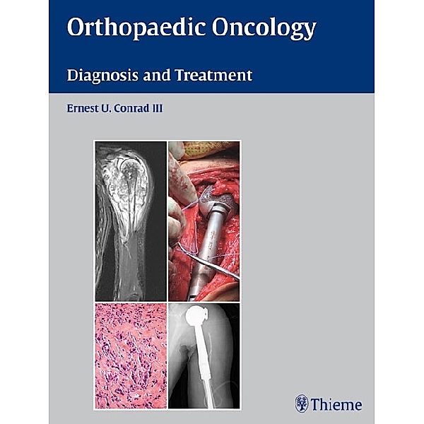 Orthopaedic Oncology, Ernest U. Conrad