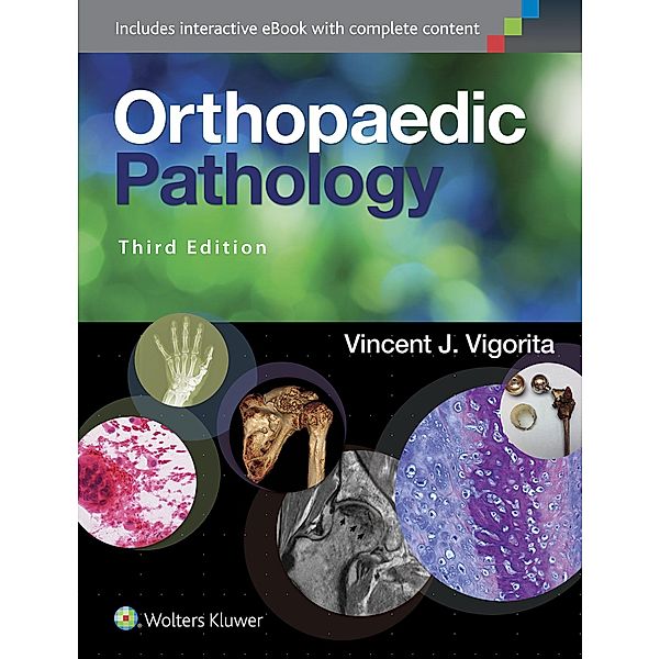 Orthopaedic Pathology, Vincent J. Vigorita