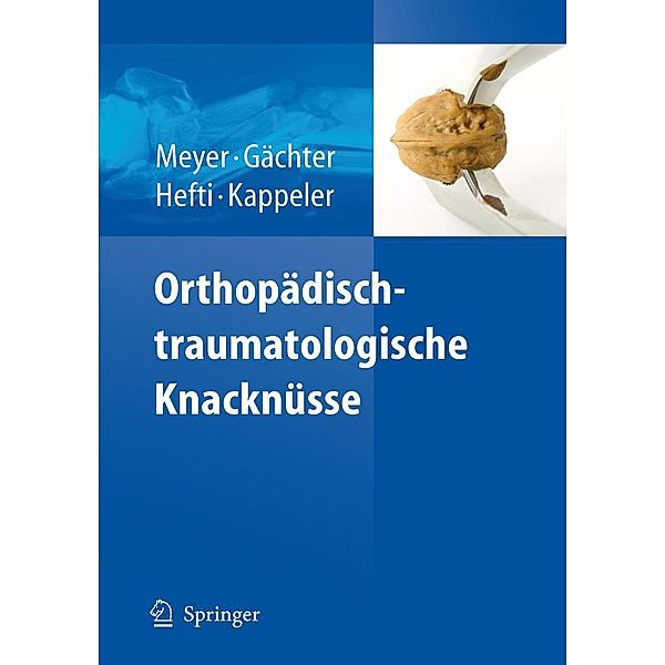 Orthopädisch-traumatologische Knacknüsse