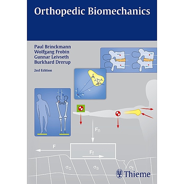 Orthopedic Biomechanics, Paul Brinckmann, Wolfgang Frobin, Gunnar Leivseth, Burkhard Drerup