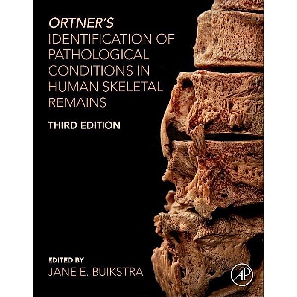 Ortner's Identification of Pathological Conditions in Human Skeletal Remains