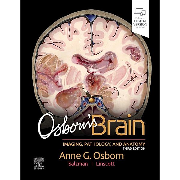 Osborn's Brain, Anne G. Osborn, Luke L. Linscott, Karen L. Salzman