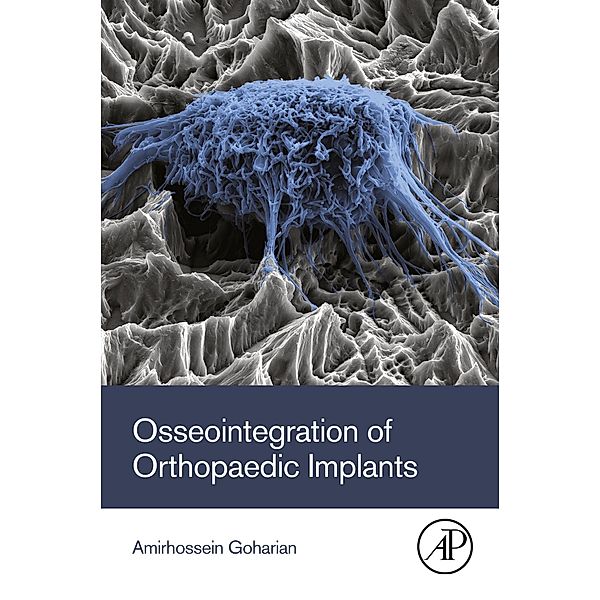 Osseointegration of Orthopaedic Implants, Amirhossein Goharian