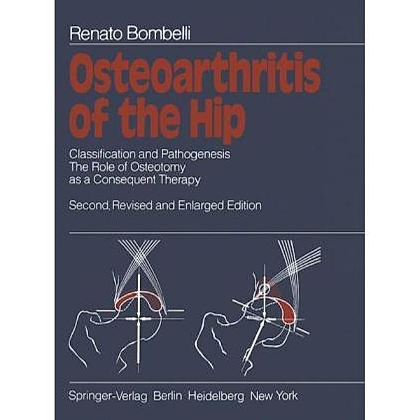 Osteoarthritis of the Hip, Renato Bombelli