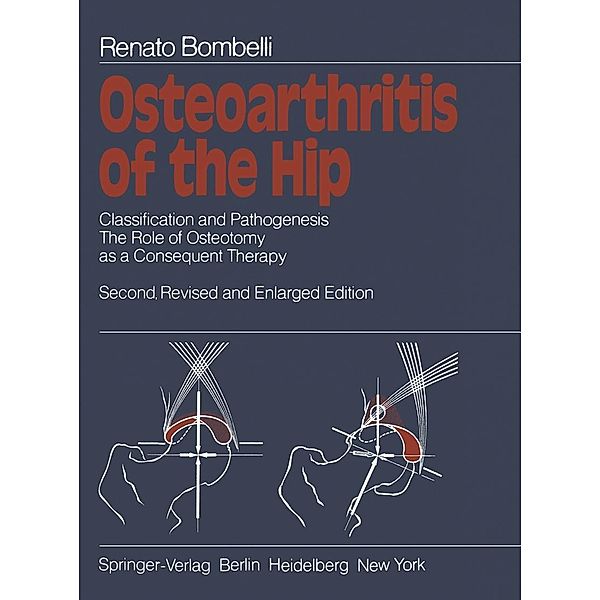 Osteoarthritis of the Hip, Renato Bombelli