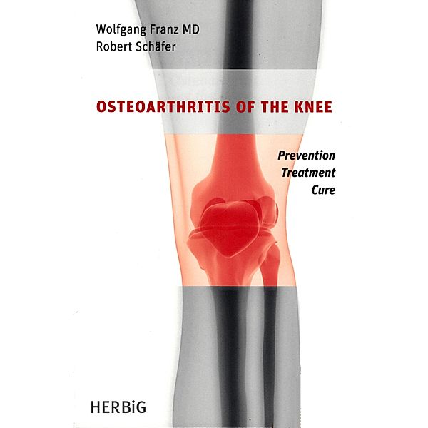 Osteoarthritis of the knee, Wolfgang Franz, Robert Schäfer
