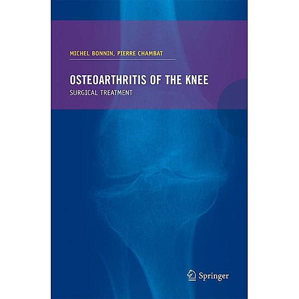 Osteoarthritis of the knee