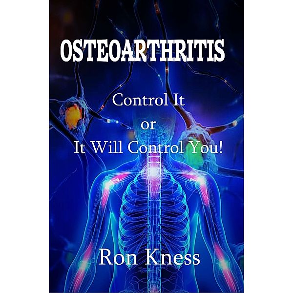 Osteoarthritis (Senior Health, #1) / Senior Health, Ron Kness