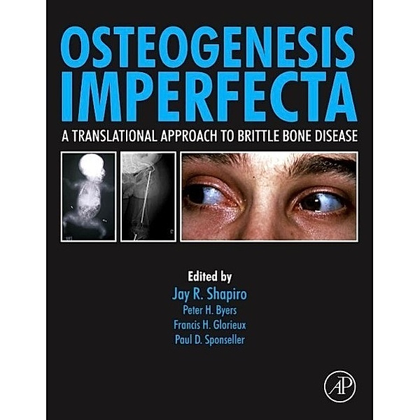 Osteogenesis Imperfecta: A Translational Approach to Brittle Bone Disease, Jay Shapiro