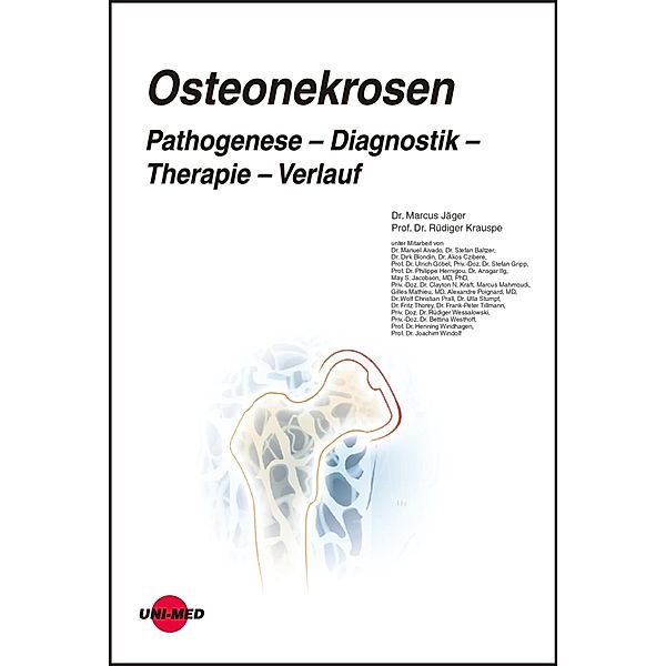 Osteonekrosen. Pathogenese - Diagnostik - Therapie - Verlauf / UNI-MED Science, Marcus Jäger, Rüdiger Krausp