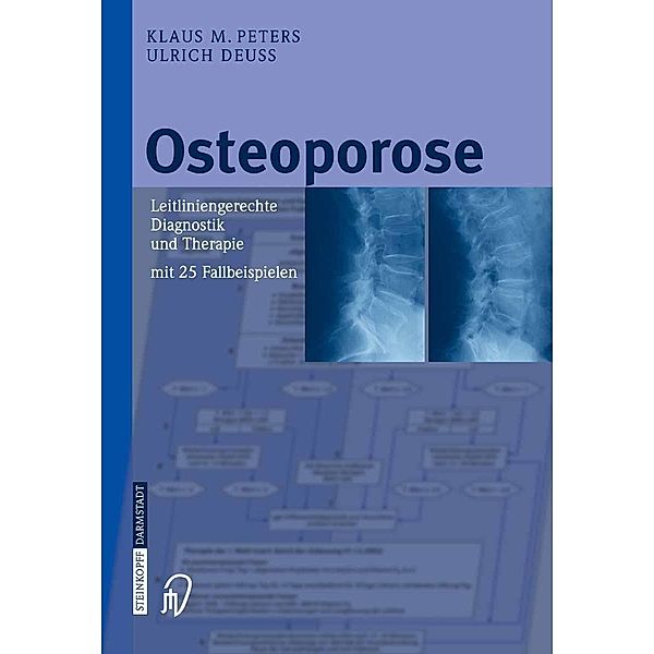 Osteoporose, Klaus M. Peters, Ulrich Deuß