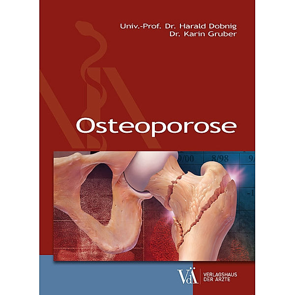 Osteoporose, Karin Gruber, Harald Dobnig