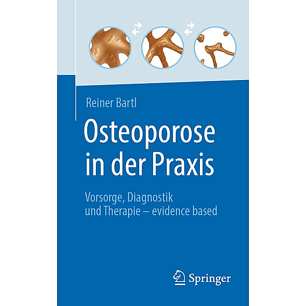Osteoporose in der Praxis, Reiner Bartl