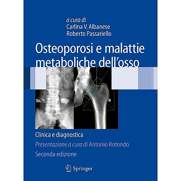 Osteoporosi e malattie metaboliche dell'osso, Roberto Passariello, Carlina Albanese