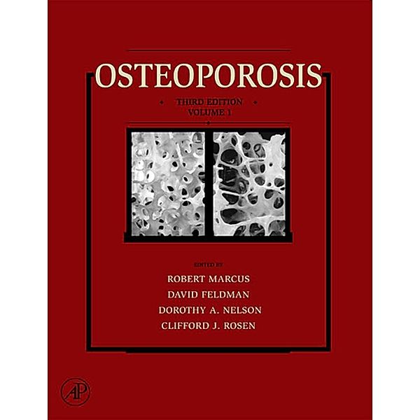 Osteoporosis