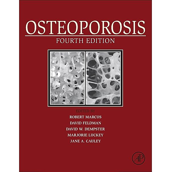 Osteoporosis