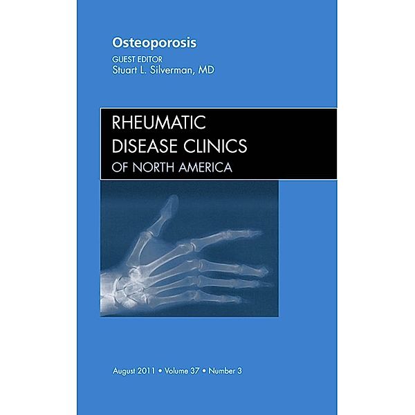 Osteoporosis, An Issue of Rheumatic Disease Clinics, Stuart L. Silverman