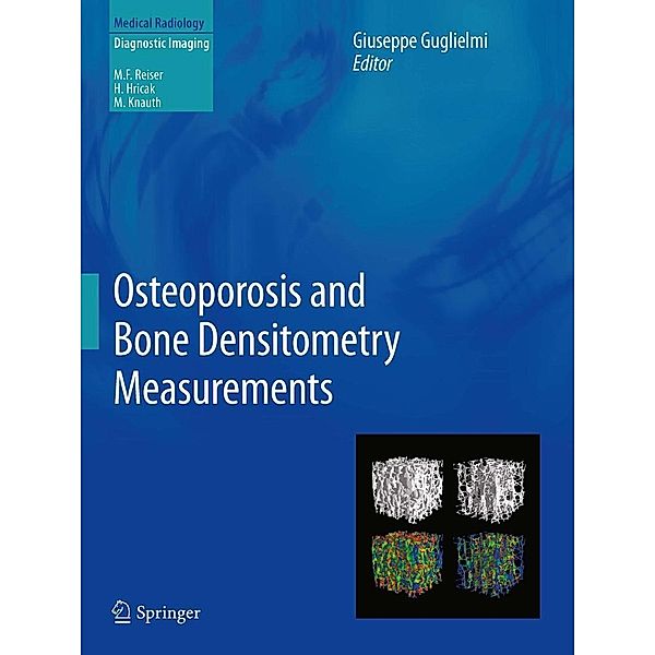 Osteoporosis and Bone Densitometry Measurements / Medical Radiology