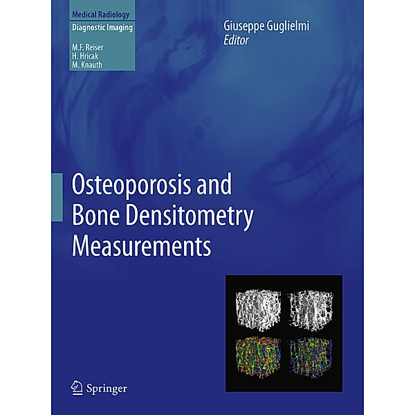 Osteoporosis and Bone Densitometry Measurements