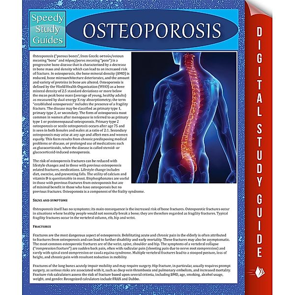 Osteoporosis / Dot EDU, Speedy Publishing