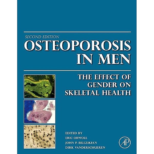 Osteoporosis in Men