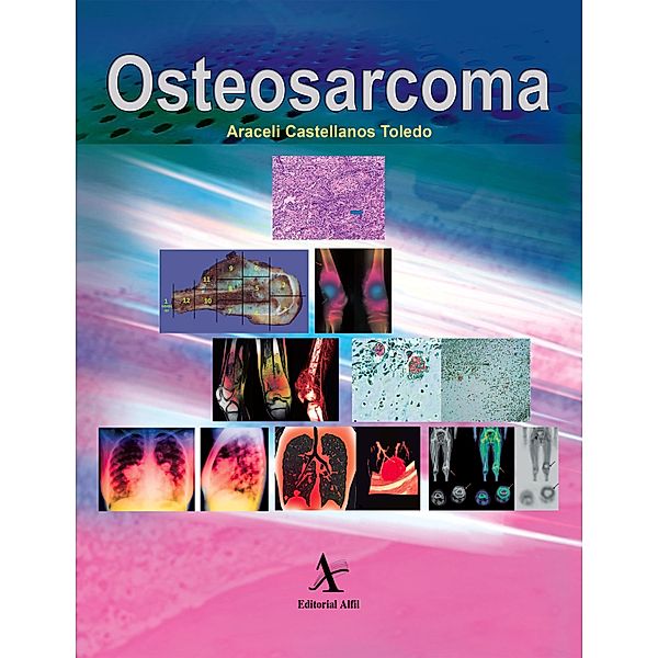 Osteosarcoma, Araceli Castellanos Toledo, Armando B. Martínez Ávalos, Rodolfo R. Rodríguez Jurado