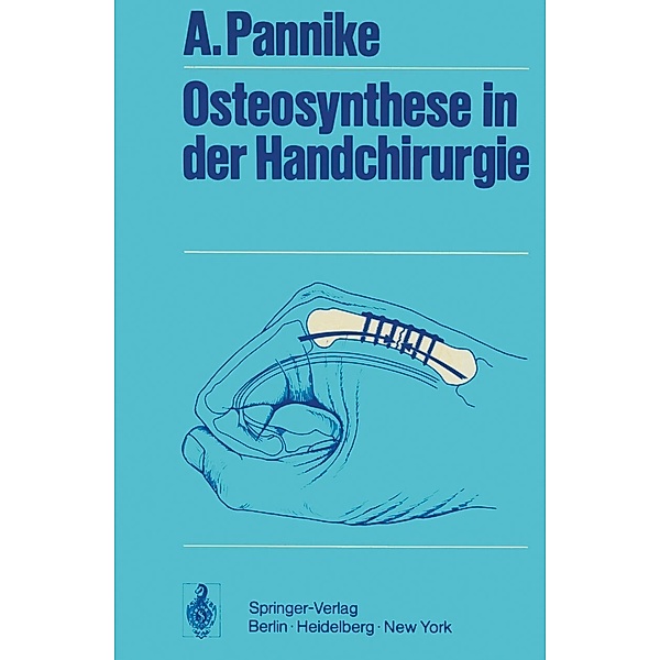 Osteosynthese in der Handchirurgie, A. Pannike