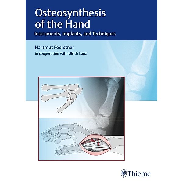 Osteosynthesis of the Hand, Hartmut Förstner