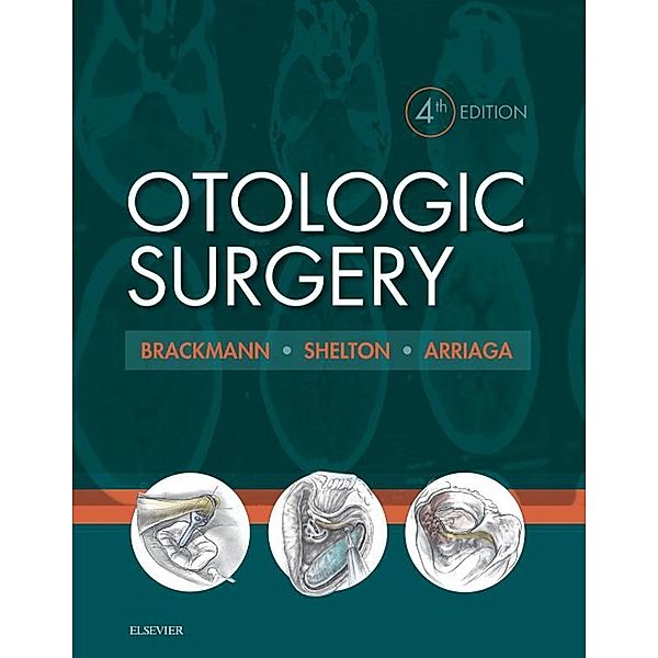Otologic Surgery E-Book, Clough Shelton, Derald Brackmann, Moses A. Arriaga