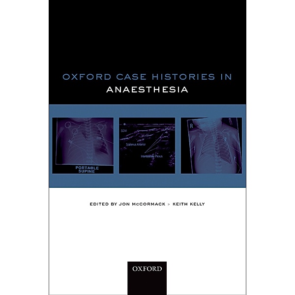 Oxford Case Histories in Anaesthesia / Oxford Case Histories