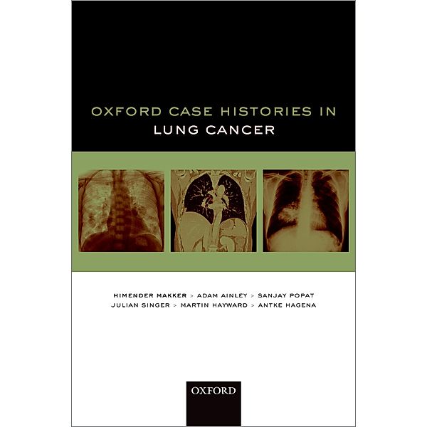 Oxford Case Histories in Lung Cancer / Oxford Case Histories, Himender K. Makker, Adam Ainley, Sanjay Popat, Julian Singer, Martin Hayward, Antke Hagena