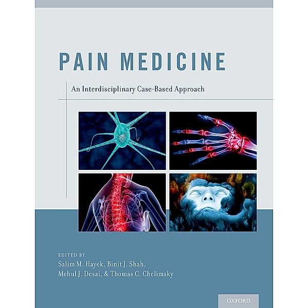 Pain Medicine