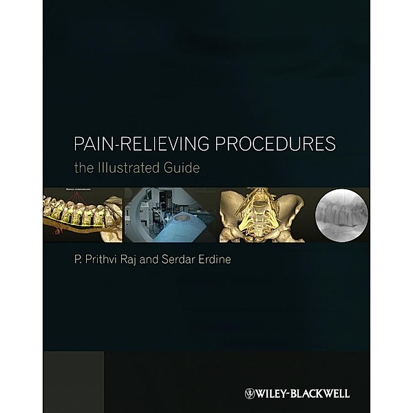 Pain-Relieving Procedures, P. Prithvi Raj, Serdar Erdine