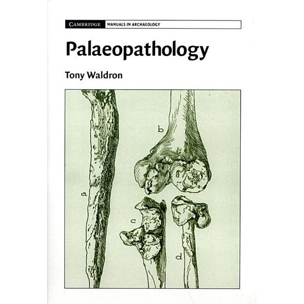 Palaeopathology, Tony Waldron