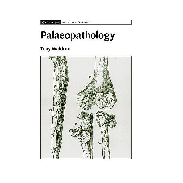 Palaeopathology / Cambridge Manuals in Archaeology, Tony Waldron