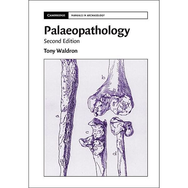 Palaeopathology / Cambridge Manuals in Archaeology, Tony Waldron