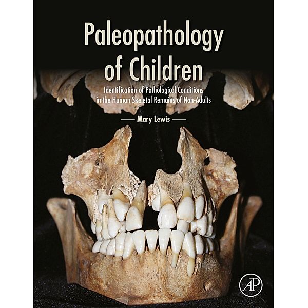 Paleopathology of Children, Mary Lewis
