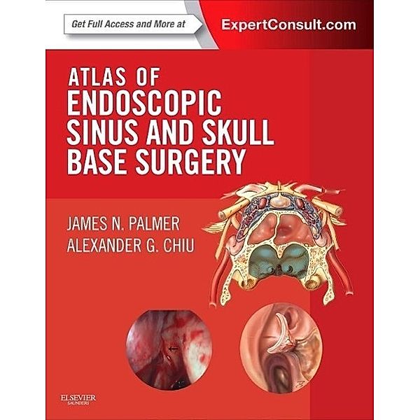 Palmer, J: Atlas of Endoscopic Sinus and Skull Base Surgery, James N. Palmer, Alexander G. Chiu