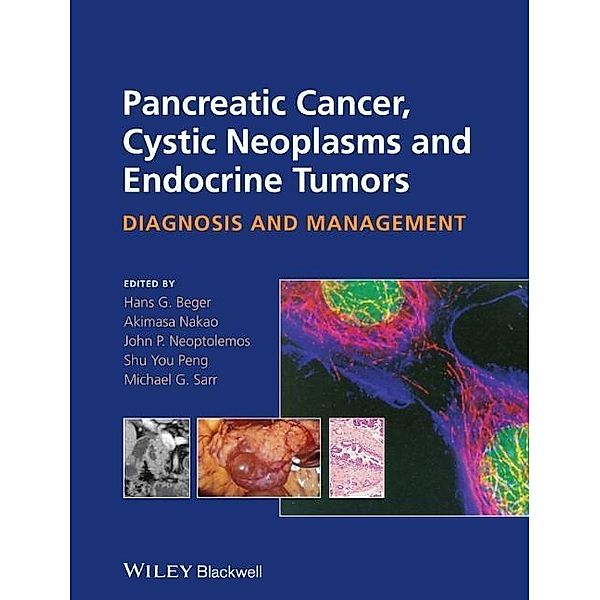 Pancreatic Cancer, Cystic Neoplasms and Endocrine Tumors