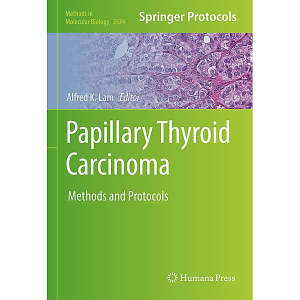 Papillary Thyroid Carcinoma