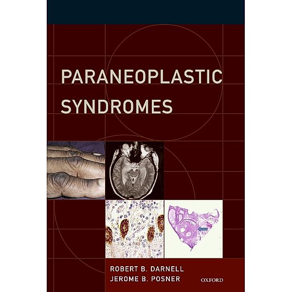 Paraneoplastic Syndromes / Contemporary Neurology Series Bd.79, Robert B. MD Darnell, Jerome B. MD Posner