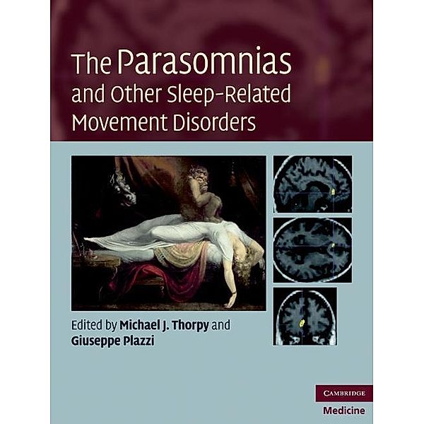 Parasomnias and Other Sleep-Related Movement Disorders