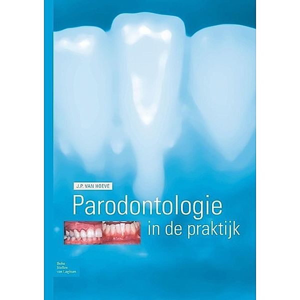Parodontologie in de praktijk, J. P. van Hoeve