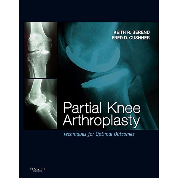 Partial Knee Arthroplasty E-Book, Fred Cushner, Keith R. Berend