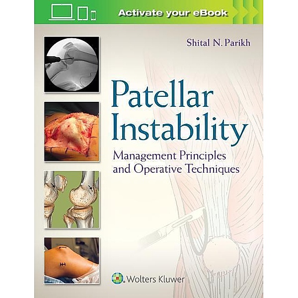 Patellar Instability: Management Principles and Operative Techniques