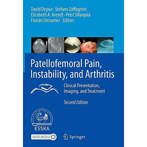 Patellofemoral Pain, Instability, and Arthritis