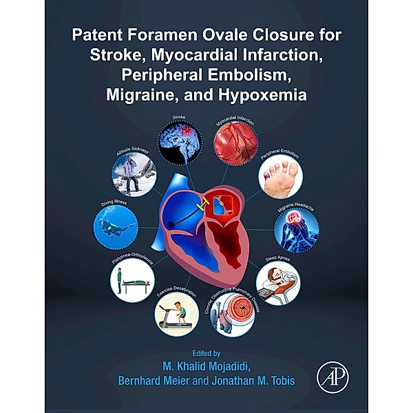 Patent Foramen Ovale Closure for Stroke, Myocardial Infarction, Peripheral Embolism, Migraine, and Hypoxemia