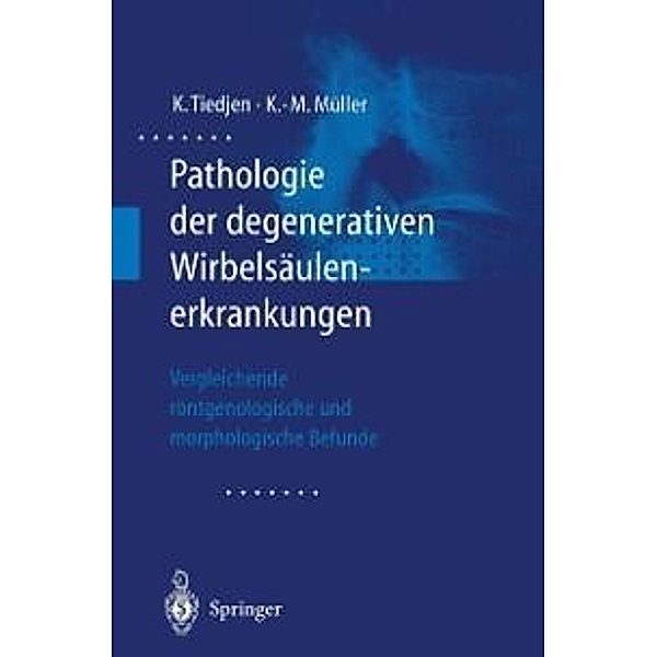 Pathologie der degenerativen Wirbelsäulenerkrankungen, Kay Tiedjen, Klaus-Michael Müller