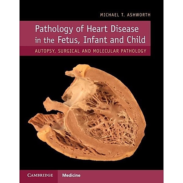 Pathology of Heart Disease in the Fetus, Infant and Child, Michael T. Ashworth